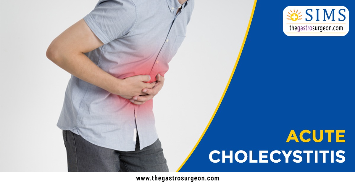 Acute Cholecystitis