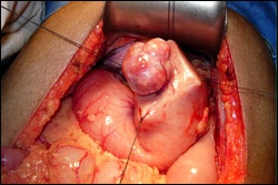 gastricsurgery2 DrPATTAS gastric surgery