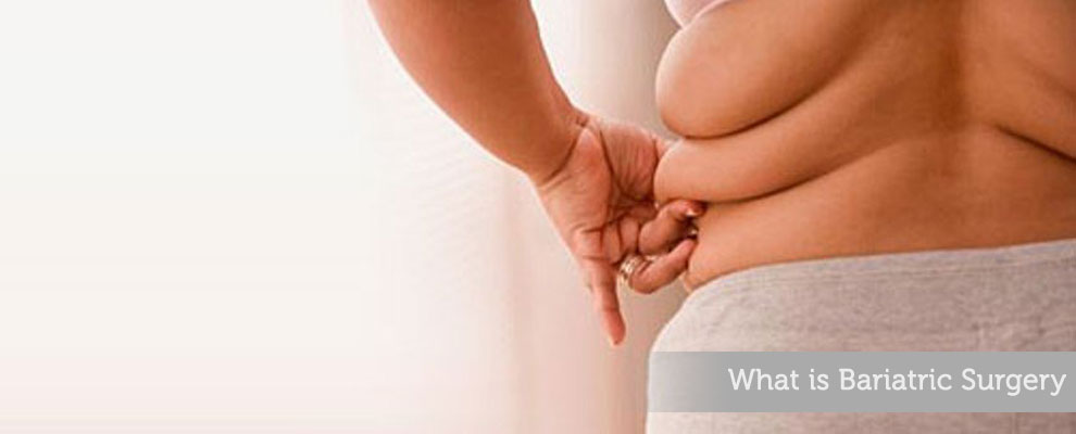 Bariatric Surgery Types, Benefits, and Expert Care