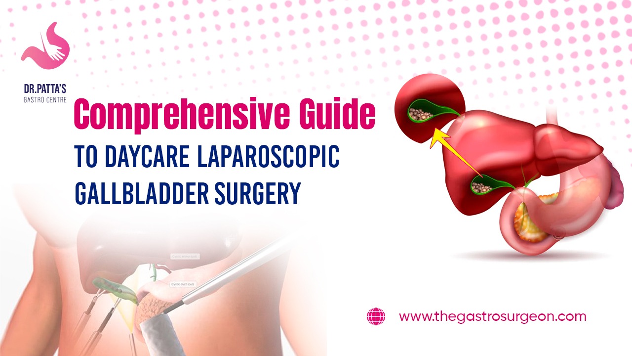 A Comprehensive Guide to Daycare Laparoscopic Gallbladder Surgery