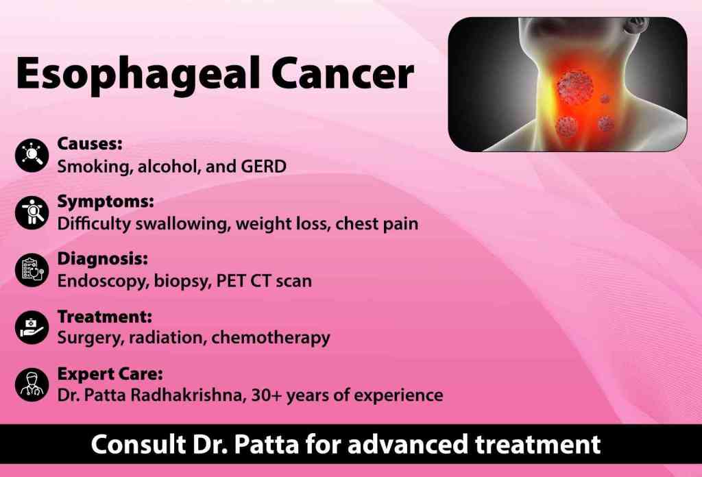 Esophageal cancer symptoms DrPATTAS Esophageal cancer symptoms and treatment Dr Patta's Gastro Center
