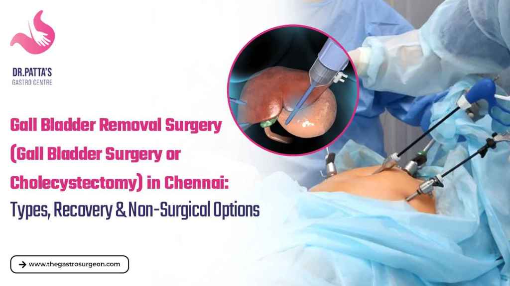 Gallbladder Surgery in Chennai DrPATTAS Gall Bladder Removal Surgery Gall Bladder Surgery or Cholecystectomy in Chennai Types Recovery Non Surgical Options
